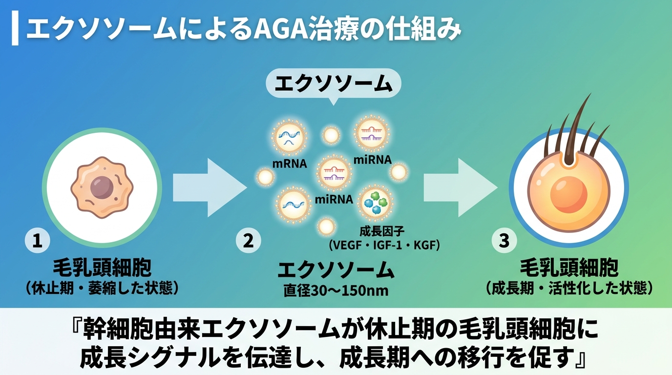 タイトル: エクソソームによるAGA治療の仕組み。イラスト図解: 左側に「毛乳頭細胞」アイコン（休止期・萎縮した状態）、中央に矢印と「エクソソーム」粒子（直径30〜150nm）のアイコン、右側に「毛乳頭細胞」アイコン（成長期・活性化した状態）。エクソソーム粒子の内部にmRNA・miRNA・成長因子（VEGF・IGF-1・KGF）のラベル。下部にキャプション: 『幹細胞由来エクソソームが休止期の毛乳頭細胞に成長シグナルを伝達し、成長期への移行を促す』