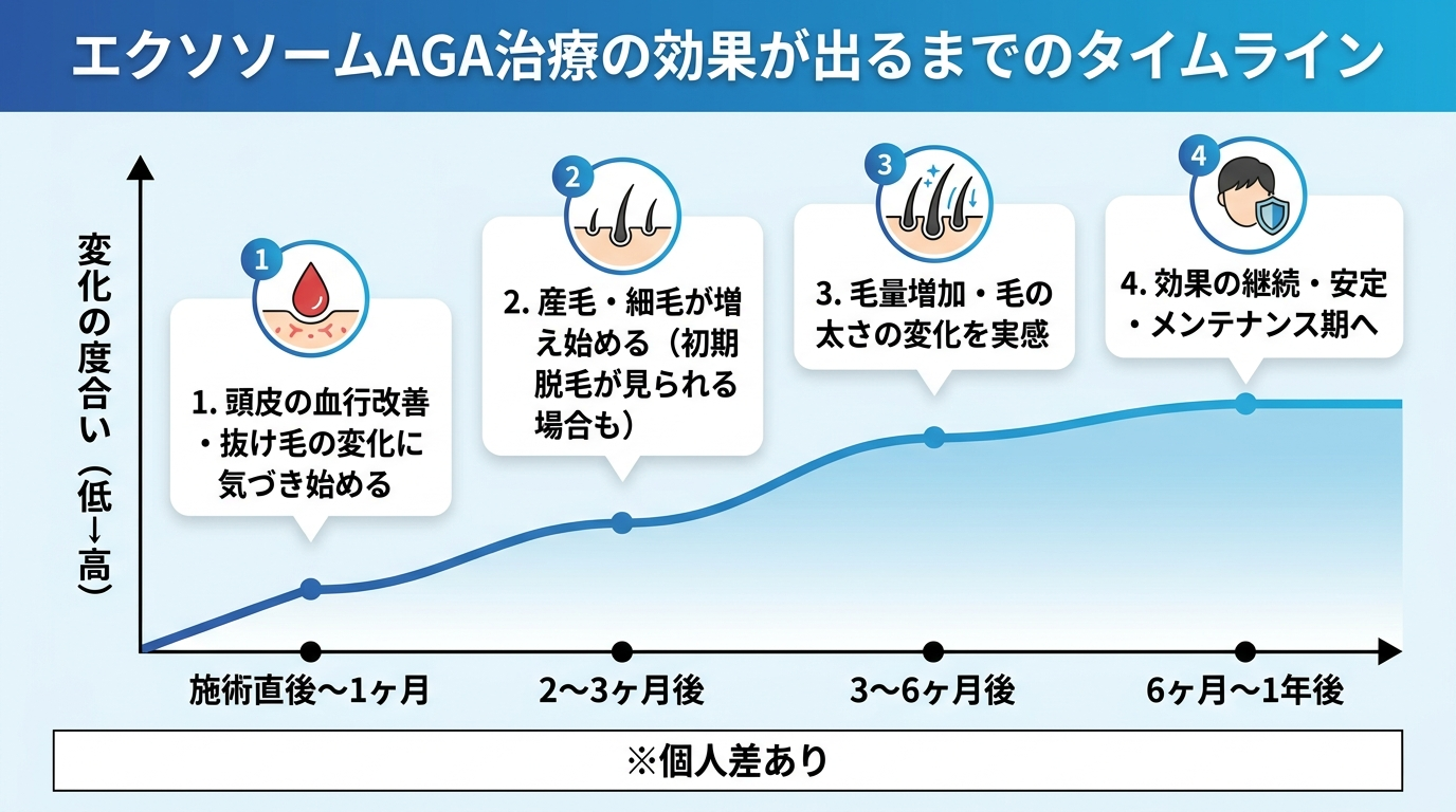 タイトル: エクソソームAGA治療の効果が出るまでのタイムライン。横軸に時期（施術直後〜1ヶ月 / 2〜3ヶ月後 / 3〜6ヶ月後 / 6ヶ月〜1年後）、縦軸に変化の度合い（低→高）の折れ線グラフ。各時期のラベル: 施術直後〜1ヶ月: 頭皮の血行改善・抜け毛の変化に気づき始める。2〜3ヶ月後: 産毛・細毛が増え始める（初期脱毛が見られる場合も）。3〜6ヶ月後: 毛量増加・毛の太さの変化を実感。6ヶ月〜1年後: 効果の継続・安定・メンテナンス期へ。下部に注記: 個人差あり