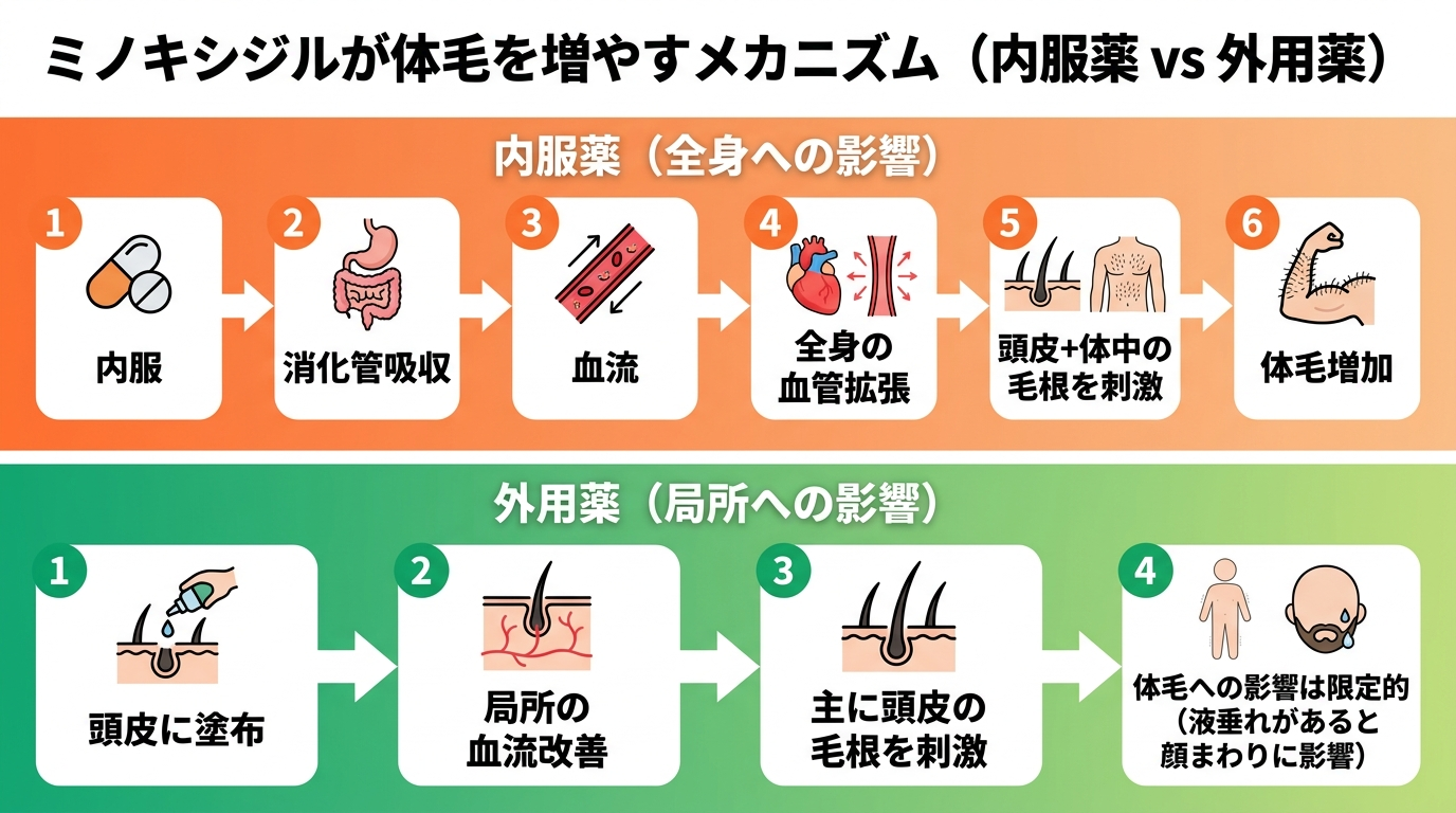 タイトル: ミノキシジルが体毛を増やすメカニズム（内服薬 vs 外用薬）。フロー図2本。上段（内服薬）: 「内服→消化管吸収→血流→全身の血管拡張→頭皮+体中の毛根を刺激→体毛増加」。下段（外用薬）: 「頭皮に塗布→局所の血流改善→主に頭皮の毛根を刺激→体毛への影響は限定的（液垂れがあると顔まわりに影響）」。背景色: 内服薬=オレンジ系、外用薬=グリーン系