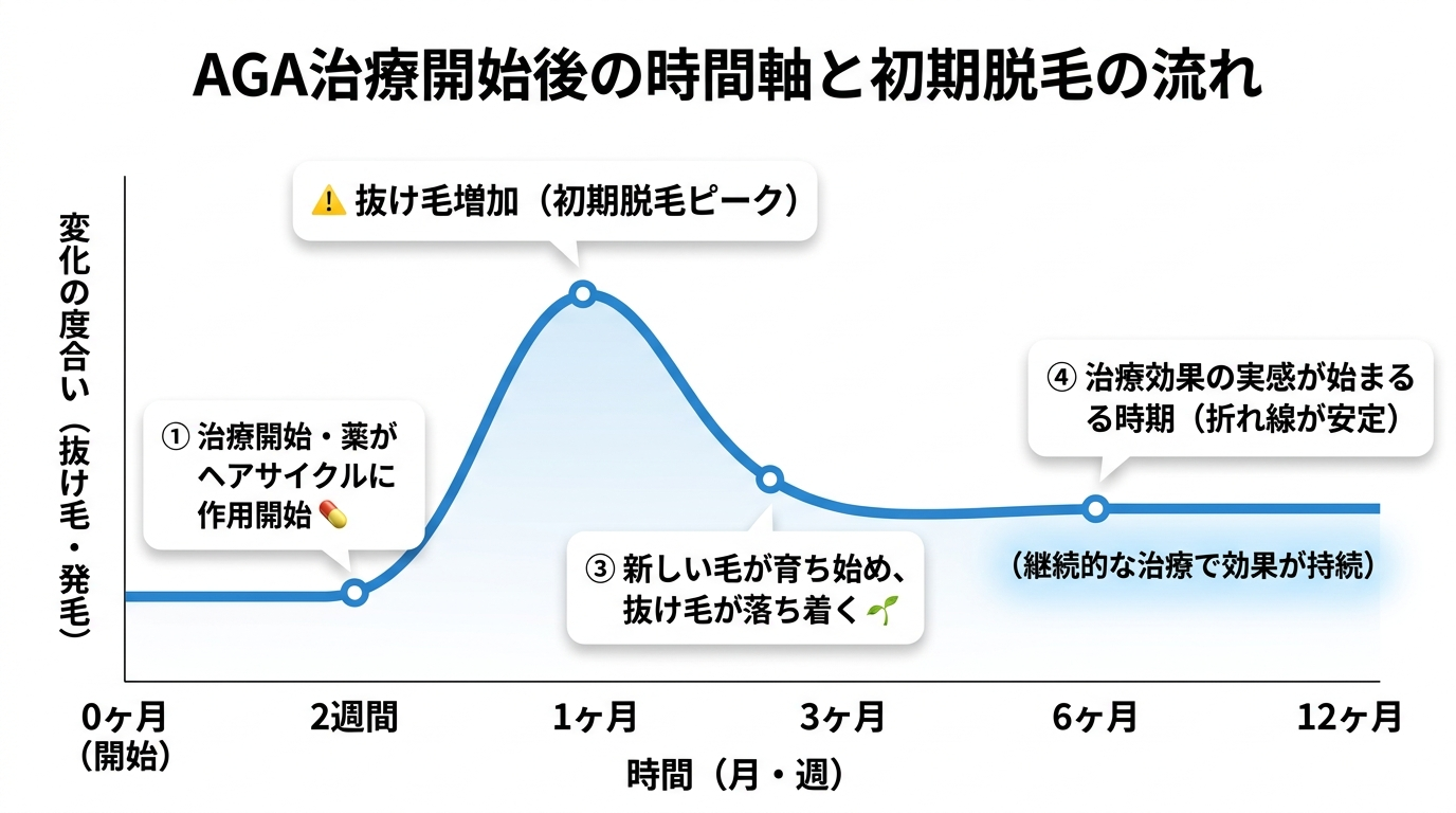 タイトル: AGA治療開始後の時間軸と初期脱毛の流れ。横軸が時間(0〜12ヶ月)の折れ線グラフ: 0〜2週: 治療開始・薬がヘアサイクルに作用開始。2週〜1ヶ月: 抜け毛増加(初期脱毛ピーク、折れ線が山形)。1〜3ヶ月: 新しい毛が育ち始め、抜け毛が落ち着く(折れ線が下降)。3〜6ヶ月以降: 治療効果の実感が始まる時期(折れ線が安定)。ポイントに吹き出しコメントあり。背景は白、折れ線は青。