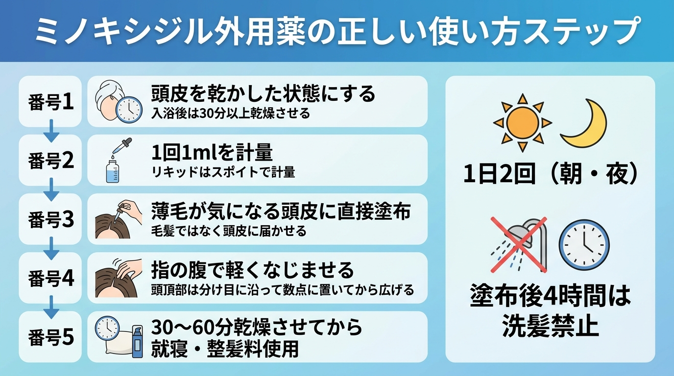 タイトル: ミノキシジル外用薬の正しい使い方ステップ。縦並びのフロー図（5ステップ）: ステップ1: 頭皮を乾かした状態にする（入浴後は30分以上乾燥させる）。ステップ2: 1回1mlを計量（リキッドはスポイトで計量）。ステップ3: 薄毛が気になる頭皮に直接塗布（毛髪ではなく頭皮に届かせる）。ステップ4: 指の腹で軽くなじませる（頭頂部は分け目に沿って数点に置いてから広げる）。ステップ5: 30〜60分乾燥させてから就寝・整髪料使用。右側注記: 1日2回（朝・夜）、塗布後4時間は洗髪禁止