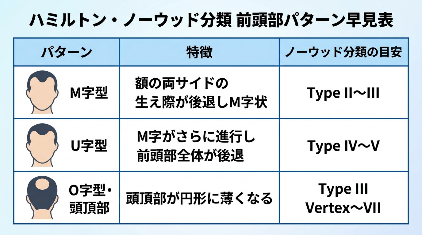 タイトル: ハミルトン・ノーウッド分類 前頭部パターン早見表。3列の表: ヘッダー行: パターン | 特徴 | ノーウッド分類の目安。行1: M字型(図: 額の両サイドの生え際が後退したシルエット) | 額の両サイドの生え際が後退しM字状 | Type II〜III。行2: U字型(図: 前頭部全体が後退したシルエット) | M字がさらに進行し前頭部全体が後退 | Type IV〜V。行3: O字型・頭頂部(図: 頭頂部が円形に薄いシルエット) | 頭頂部が円形に薄くなる | Type III Vertex〜VII