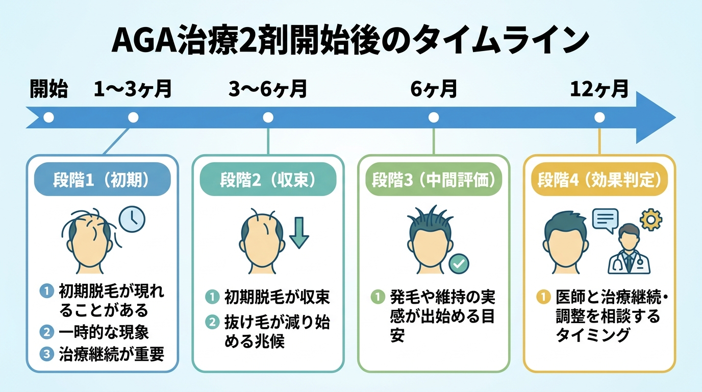 タイトル: AGA治療2剤開始後のタイムライン。横軸が時間軸（開始〜12ヶ月）の流れ図。段階1（1〜3ヶ月）: 初期脱毛が現れることがある（一時的な現象・治療継続が重要）。段階2（3〜6ヶ月）: 初期脱毛が収束・抜け毛が減り始める兆候。段階3（6ヶ月）: 中間評価・発毛や維持の実感が出始める目安。段階4（12ヶ月）: 本格的な効果判定・医師と治療継続・調整を相談するタイミング