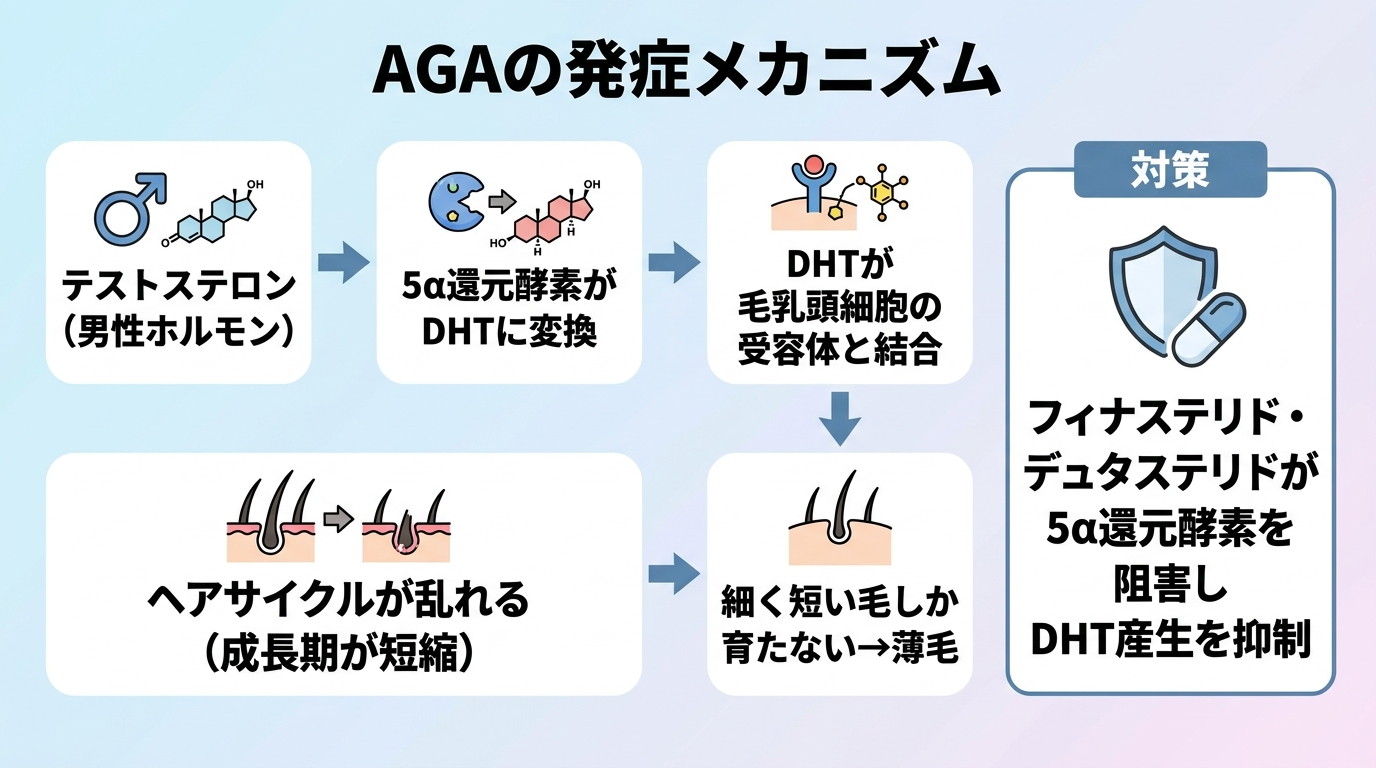 DHTがヘアサイクルを乱す仕組みのフロー図。タイトル: AGAの発症メカニズム。ステップ1(右矢印): テストステロン(男性ホルモン)。ステップ2(右矢印): 5α還元酵素がDHTに変換。ステップ3(右矢印): DHTが毛乳頭細胞の受容体と結合。ステップ4(下矢印): ヘアサイクルが乱れる(成長期が短縮)。ステップ5: 細く短い毛しか育たない→薄毛。右側に対策ボックス: フィナステリド・デュタステリドが5α還元酵素を阻害しDHT産生を抑制