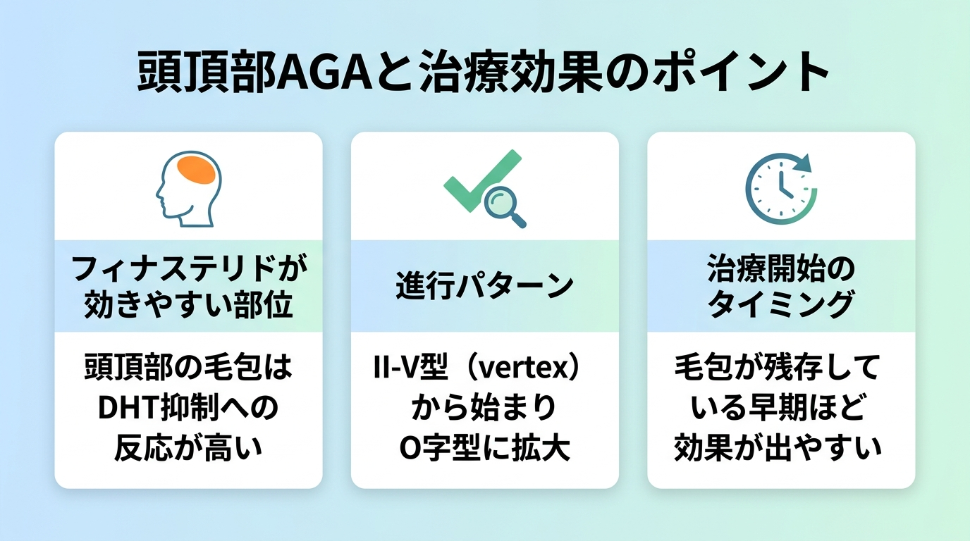 タイトル: 頭頂部AGAと治療効果のポイント。3カードの横並びレイアウト。カード1（頭部のアイコン）ヘッダー: フィナステリドが効きやすい部位、説明: 頭頂部の毛包はDHT抑制への反応が高い。カード2（チェックマークのアイコン）ヘッダー: 進行パターン、説明: II-V型（vertex）から始まりO字型に拡大。カード3（時計のアイコン）ヘッダー: 治療開始のタイミング、説明: 毛包が残存している早期ほど効果が出やすい