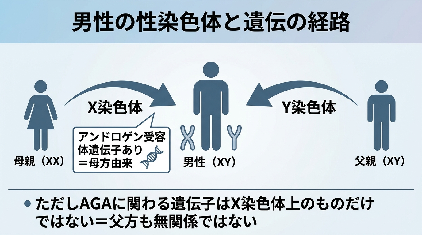 タイトル: 男性の性染色体と遺伝の経路。図解: 中央に男性（XY）、左に母親（XX）から矢印で『X染色体』、右に父親（XY）から矢印で『Y染色体』。X染色体に『アンドロゲン受容体遺伝子あり＝母方由来』と注記。下部に『ただしAGAに関わる遺伝子はX染色体上のものだけではない＝父方も無関係ではない』と補足