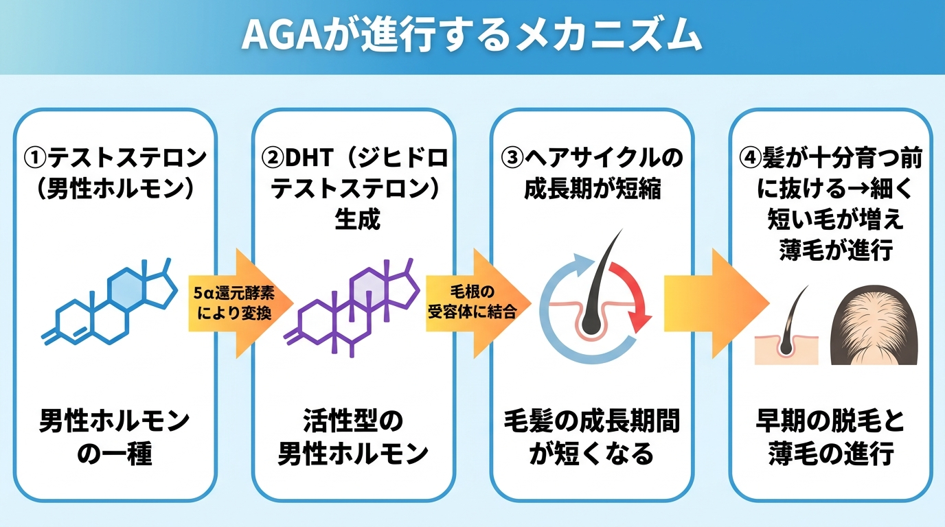 タイトル: AGAが進行するメカニズム。フロー図で左から右へ4ステップ: ステップ1: テストステロン（男性ホルモン）。矢印（5α還元酵素により変換）。ステップ2: DHT（ジヒドロテストステロン）生成。矢印（毛根の受容体に結合）。ステップ3: ヘアサイクルの成長期が短縮。矢印。ステップ4: 髪が十分育つ前に抜ける→細く短い毛が増え薄毛が進行