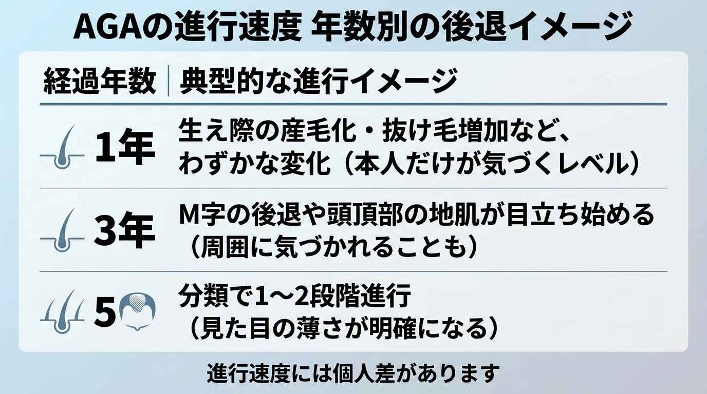 タイトル: AGAの進行速度 年数別の後退イメージ。3行の表形式インフォグラフィック。ヘッダー行: 経過年数 | 典型的な進行イメージ。行1: 1年 | 生え際の産毛化・抜け毛増加など、わずかな変化（本人だけが気づくレベル）。行2: 3年 | M字の後退や頭頂部の地肌が目立ち始める（周囲に気づかれることも）。行3: 5年 | 分類で1〜2段階進行（見た目の薄さが明確になる）。下部に注記: 進行速度には個人差があります