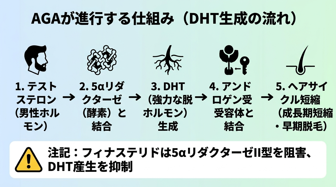 タイトル: AGAが進行する仕組み(DHT生成の流れ)。フロー図: ステップ1(テストステロン)男性ホルモン → ステップ2(5αリダクターゼ)酵素と結合 → ステップ3(DHT/ジヒドロテストステロン)強力な脱毛ホルモン生成 → ステップ4(アンドロゲン受容体)DHTが受容体と結合 → ステップ5(ヘアサイクル短縮)成長期が短くなり毛が育つ前に抜ける。最後に注記: フィナステリドは5αリダクターゼII型を阻害してDHT産生を抑える