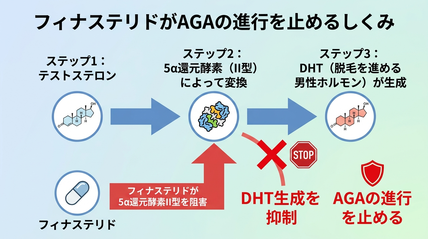 タイトル: フィナステリドがAGAの進行を止めるしくみ。フロー図: ステップ1: テストステロン。ステップ2: 5α還元酵素（II型）によって変換。ステップ3: DHT（脱毛を進める男性ホルモン）が生成。矢印で「フィナステリドが5α還元酵素II型を阻害」→ DHT生成を抑制 → AGAの進行を止める