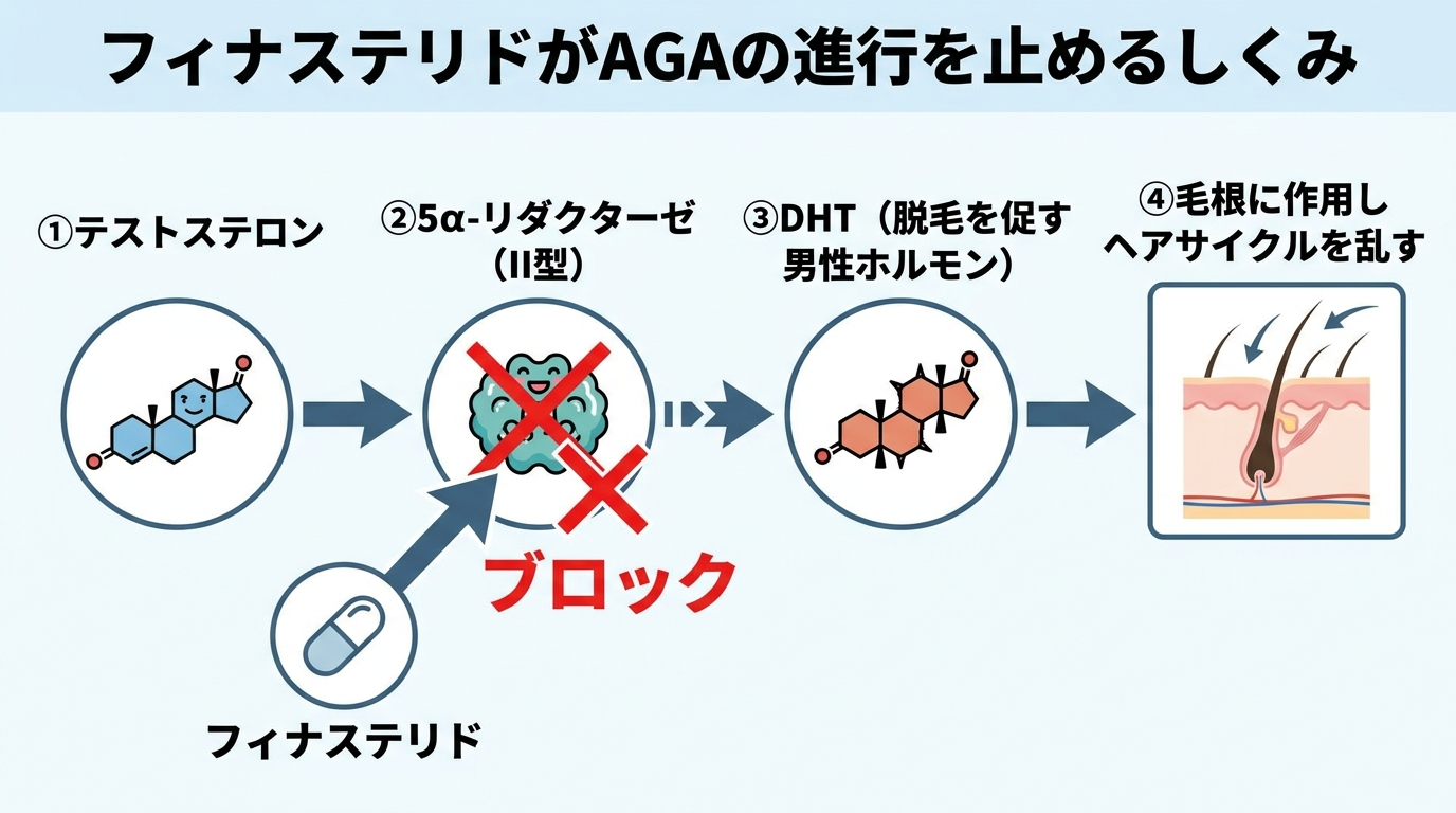 タイトル: フィナステリドがAGAの進行を止めるしくみ。フロー図: ①テストステロン → ②5α-リダクターゼ（II型）という酵素 → ③DHT（脱毛を促す男性ホルモン）→ ④毛根に作用しヘアサイクルを乱す。フィナステリドが②の5α-リダクターゼをブロックする位置を矢印とバツ印で示す