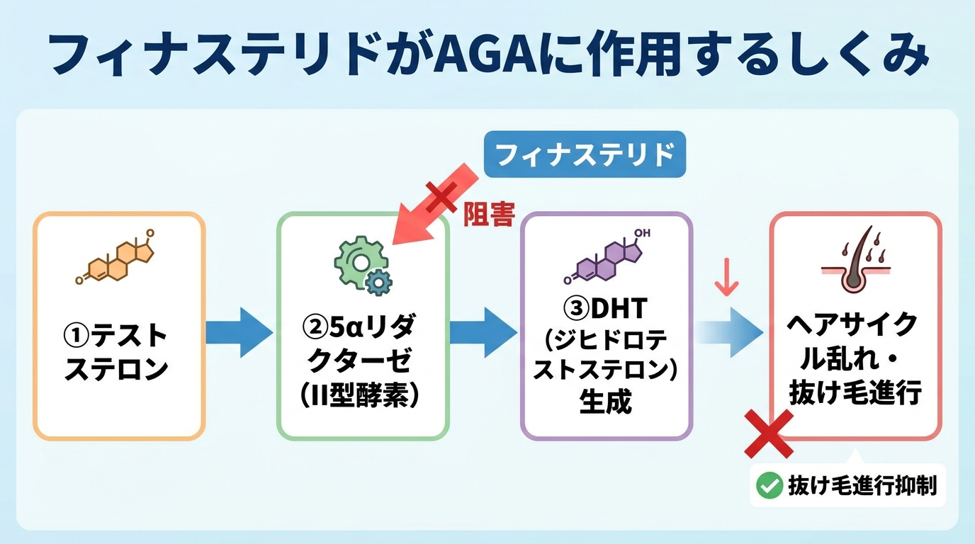タイトル: フィナステリドがAGAに作用するしくみ。フロー図: ①テストステロン → ②5αリダクターゼ(II型酵素)が変換 → ③DHT(ジヒドロテストステロン)が生成 → ④DHTがヘアサイクルを乱し抜け毛が進行。フィナステリドは②の5αリダクターゼII型を阻害し、③のDHT産生を抑えることで④の抜け毛進行を食い止める、という流れを矢印で示す