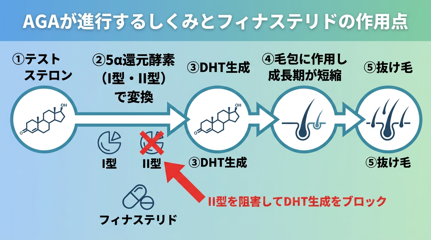 タイトル: AGAが進行するしくみとフィナステリドの作用点。フロー図: ①テストステロン → ②5α還元酵素（I型・II型）で変換 → ③DHT生成 → ④毛包に作用し成長期が短縮 → 抜け毛。フィナステリドはII型を阻害してDHT生成をブロックする旨を矢印で示す。