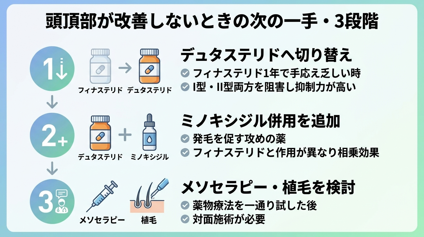 タイトル: 頭頂部が改善しないときの次の一手・3段階。縦並びステップ図で: ステップ1: デュタステリドへ切り替え(フィナステリド1年で手応え乏しい時。I型・II型両方を阻害し抑制力が高い)。ステップ2: ミノキシジル併用を追加(発毛を促す攻めの薬。フィナステリドと作用が異なり相乗効果)。ステップ3: メソセラピー・植毛を検討(薬物療法を一通り試した後。対面施術が必要)
