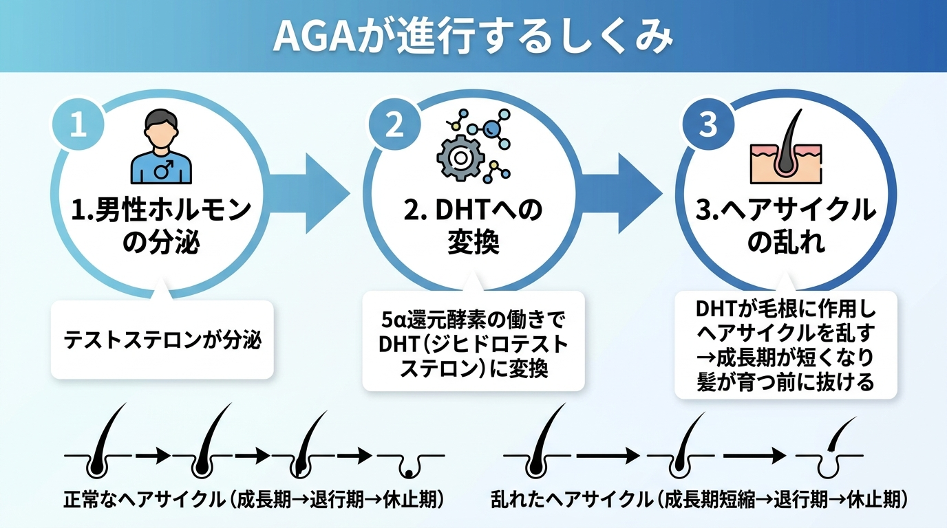 タイトル: AGAが進行するしくみ。横並び3ステップのフロー図: ステップ1(男性ホルモンのアイコン)テストステロンが分泌。ステップ2(酵素のアイコン)5α還元酵素の働きでDHT(ジヒドロテストステロン)に変換。ステップ3(毛根のアイコン)DHTが毛根に作用しヘアサイクルを乱す→成長期が短くなり髪が育つ前に抜ける