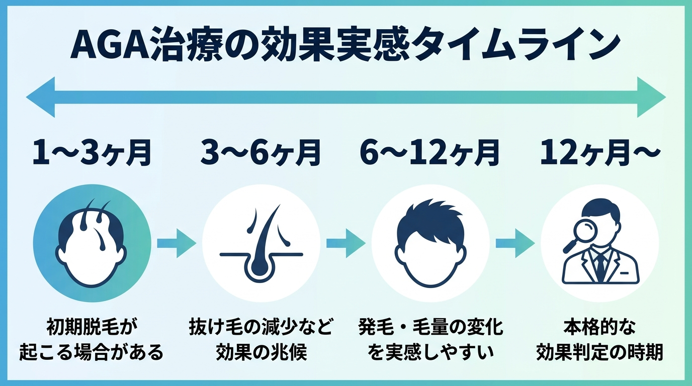 タイトル: AGA治療の効果実感タイムライン。横軸の時系列フロー4段階: 1〜3ヶ月(初期脱毛が起こる場合がある)→ 3〜6ヶ月(抜け毛の減少など効果の兆候)→ 6〜12ヶ月(発毛・毛量の変化を実感しやすい)→ 12ヶ月〜(本格的な効果判定の時期)