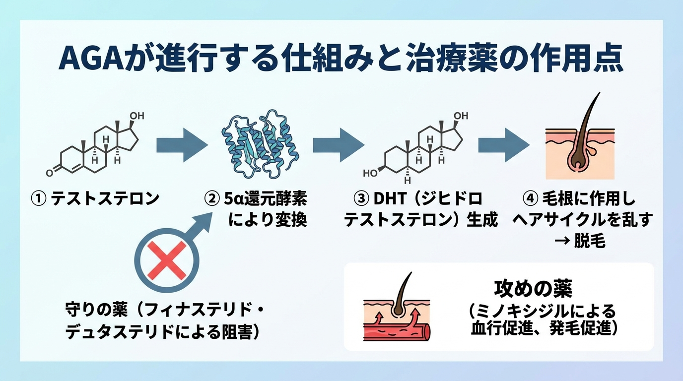 タイトル: AGAが進行する仕組みと治療薬の作用点。フロー図: ①テストステロン → ②5α還元酵素により変換 → ③DHT(ジヒドロテストステロン)生成 → ④毛根に作用しヘアサイクルを乱す → 脱毛。治療薬の作用: フィナステリド・デュタステリドは②5α還元酵素を阻害(守りの薬)、ミノキシジルは血行を促進して発毛を促す(攻めの薬)