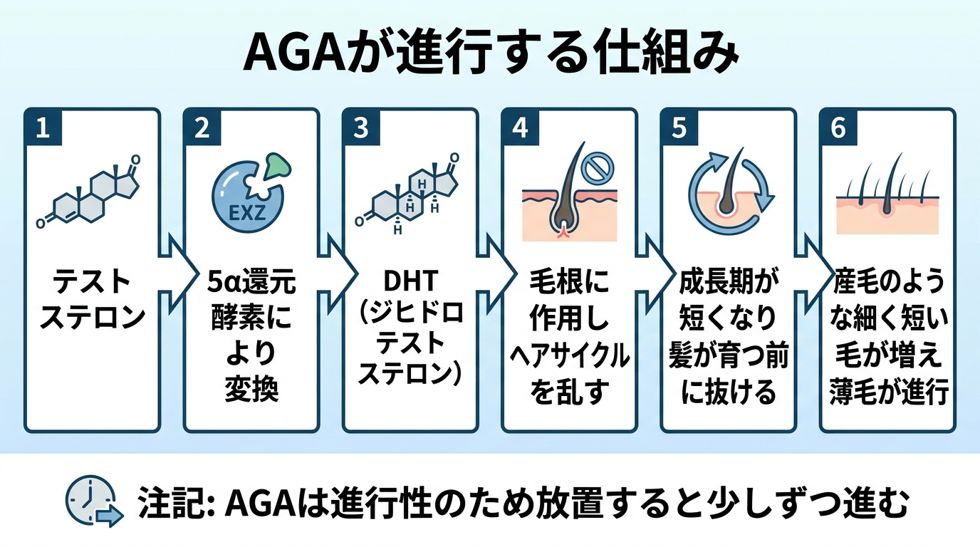 タイトル: AGAが進行する仕組み。横並びフロー図: テストステロン → (5α還元酵素により変換)→ DHT(ジヒドロテストステロン)→ 毛根に作用しヘアサイクルを乱す → 成長期が短くなり髪が育つ前に抜ける → 産毛のような細く短い毛が増え薄毛が進行。下部に注記: AGAは進行性のため放置すると少しずつ進む