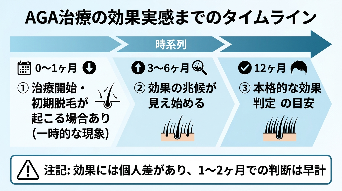 タイトル: AGA治療の効果実感までのタイムライン。横軸の時系列フロー図: 0〜1ヶ月: 治療開始・初期脱毛が起こる場合あり(一時的な現象)。3〜6ヶ月: 効果の兆候が見え始める。12ヶ月: 本格的な効果判定の目安。下部に注記: 効果には個人差があり、1〜2ヶ月での判断は早計