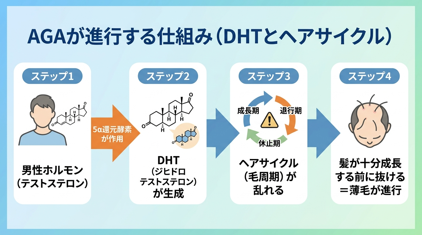 タイトル: AGAが進行する仕組み(DHTとヘアサイクル)。フロー図形式。ステップ1: 男性ホルモン(テストステロン)。矢印(5α還元酵素が作用)。ステップ2: DHT(ジヒドロテストステロン)が生成。矢印。ステップ3: ヘアサイクル(毛周期)が乱れる。矢印。ステップ4: 髪が十分成長する前に抜ける=薄毛が進行
