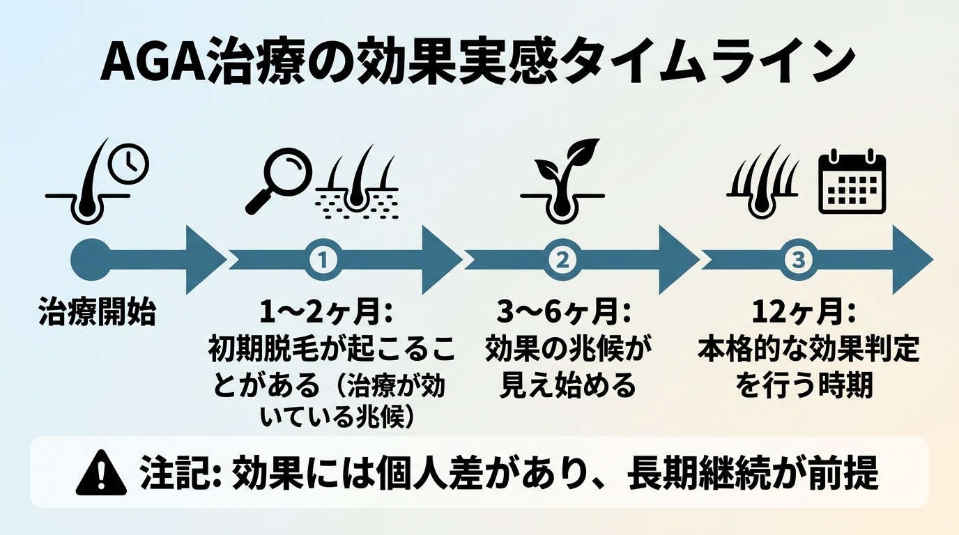 タイトル: AGA治療の効果実感タイムライン。横軸の時系列フロー図で: 1〜2ヶ月: 初期脱毛が起こることがある(治療が効いている兆候)。3〜6ヶ月: 効果の兆候が見え始める。12ヶ月: 本格的な効果判定を行う時期。注記: 効果には個人差があり、長期継続が前提