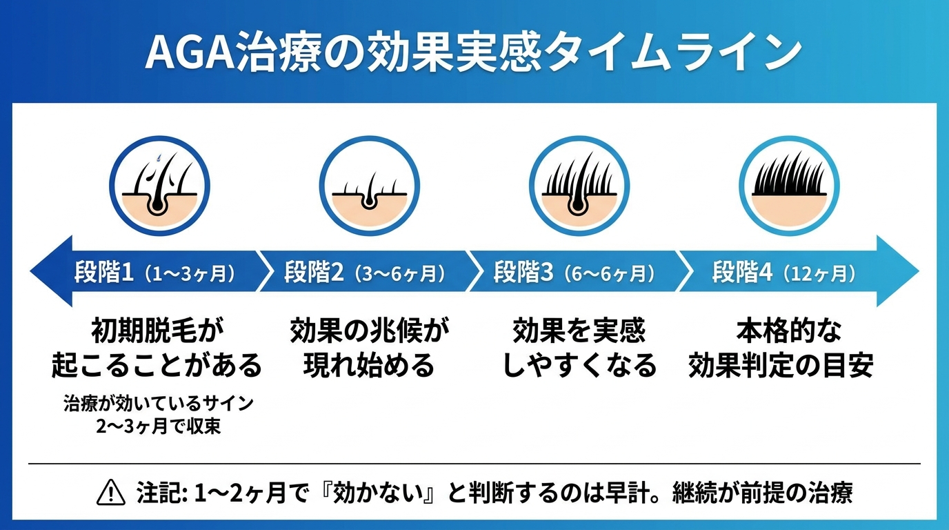 タイトル: AGA治療の効果実感タイムライン。横軸の時系列フロー図で4段階: 段階1(1〜3ヶ月)初期脱毛が起こることがある(治療が効いているサイン、2〜3ヶ月で収束)。段階2(3〜6ヶ月)効果の兆候が現れ始める。段階3(6〜12ヶ月)効果を実感しやすくなる。段階4(12ヶ月)本格的な効果判定の目安。注記: 1〜2ヶ月で『効かない』と判断するのは早計。継続が前提の治療
