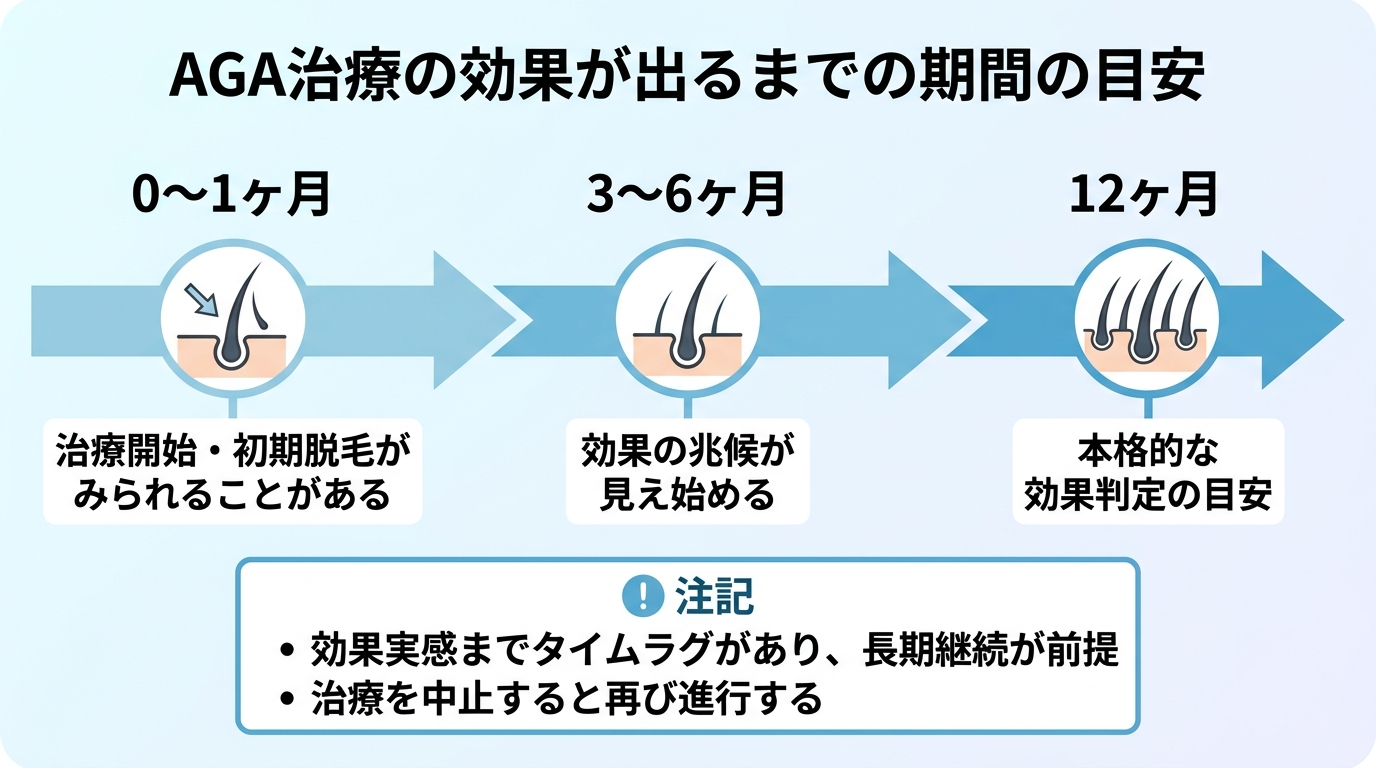 タイトル: AGA治療の効果が出るまでの期間の目安。横向きタイムライン: 0〜1ヶ月（治療開始・初期脱毛がみられることがある）→ 3〜6ヶ月（効果の兆候が見え始める）→ 12ヶ月（本格的な効果判定の目安）。下部に注記: 効果実感までタイムラグがあり、長期継続が前提。治療を中止すると再び進行する