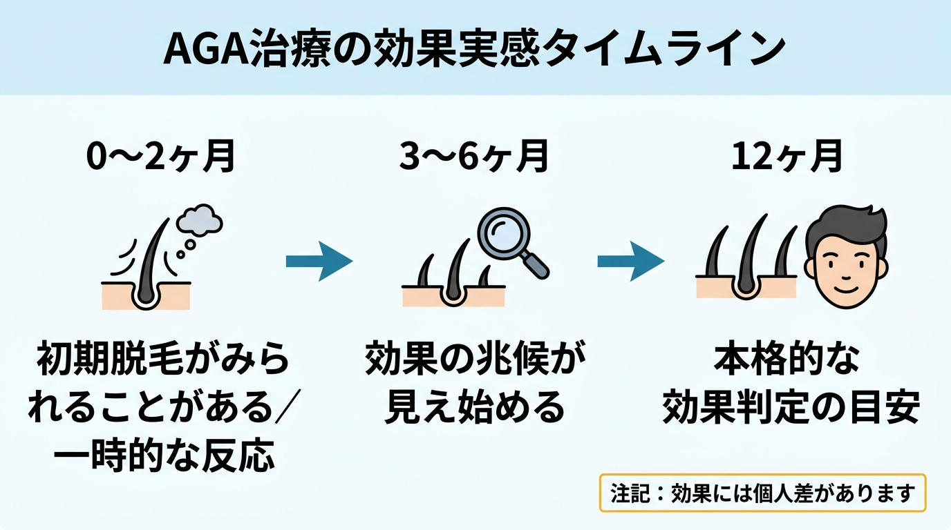 タイトル: AGA治療の効果実感タイムライン。横方向の時間軸フロー図で: 0〜2ヶ月(初期脱毛がみられることがある/一時的な反応)→ 3〜6ヶ月(効果の兆候が見え始める)→ 12ヶ月(本格的な効果判定の目安)。注記: 効果には個人差があります。