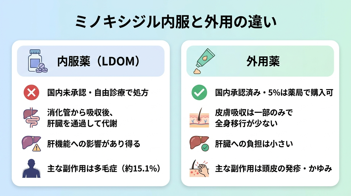 タイトル: ミノキシジル内服と外用の違い。横並び2カードで比較。カード1(飲み薬・錠剤アイコン)ヘッダー: 内服薬(LDOM)、説明: 国内未承認・自由診療で処方。消化管から吸収後、肝臓を通過して代謝。肝機能への影響があり得る。主な副作用は多毛症(約15.1%)。カード2(塗り薬・チューブアイコン)ヘッダー: 外用薬、説明: 国内承認済み・5%は薬局で購入可。皮膚吸収は一部のみで全身移行が少ない。肝臓への負担は小さい。主な副作用は頭皮の発疹・かゆみ