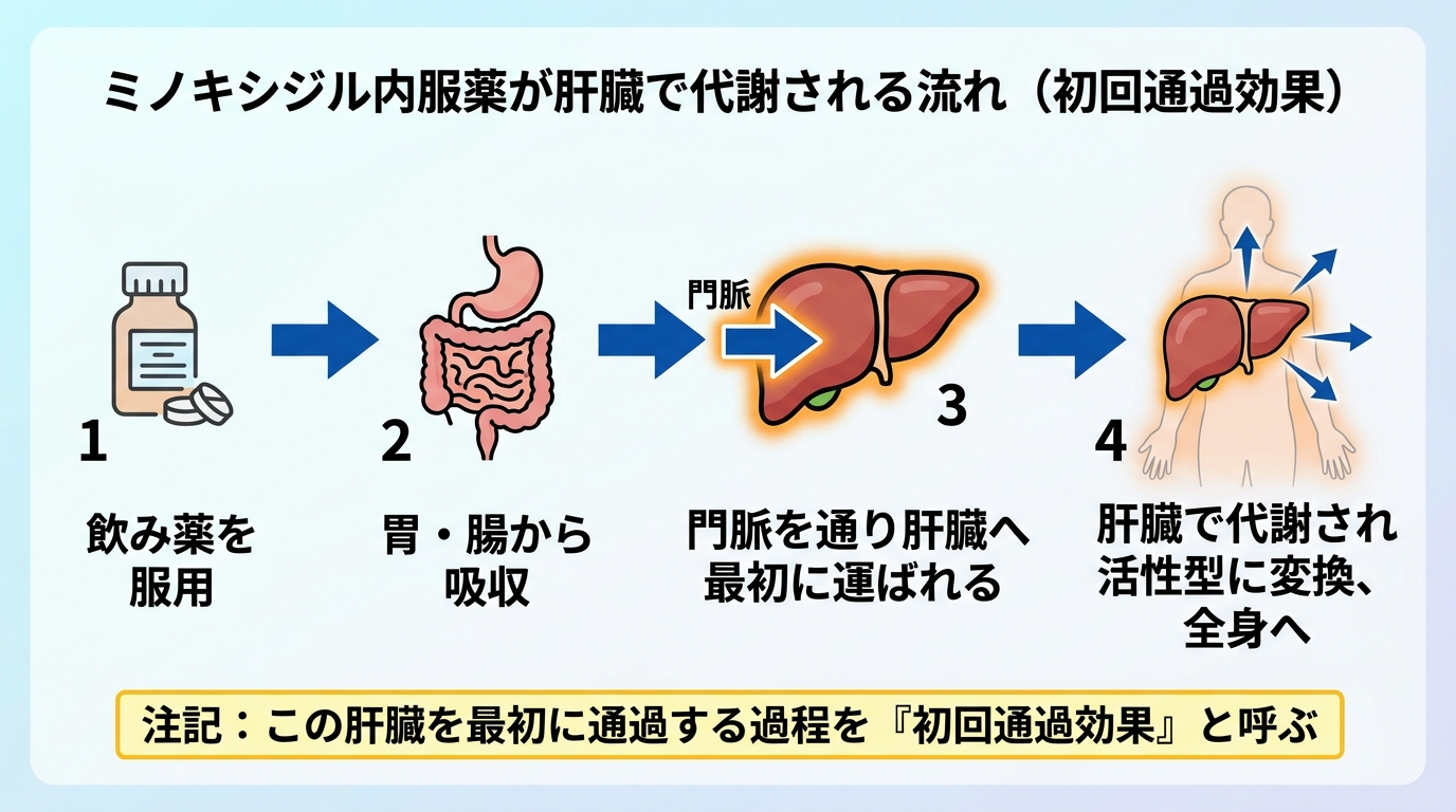 タイトル: ミノキシジル内服薬が肝臓で代謝される流れ(初回通過効果)。横方向のフロー図で4ステップ。ステップ1: 飲み薬を服用(錠剤アイコン)。ステップ2: 胃・腸から吸収(消化管アイコン)。ステップ3: 門脈を通り肝臓へ最初に運ばれる(肝臓アイコン・矢印強調)。ステップ4: 肝臓で代謝され活性型に変換、全身へ。注記: この肝臓を最初に通過する過程を『初回通過効果』と呼ぶ