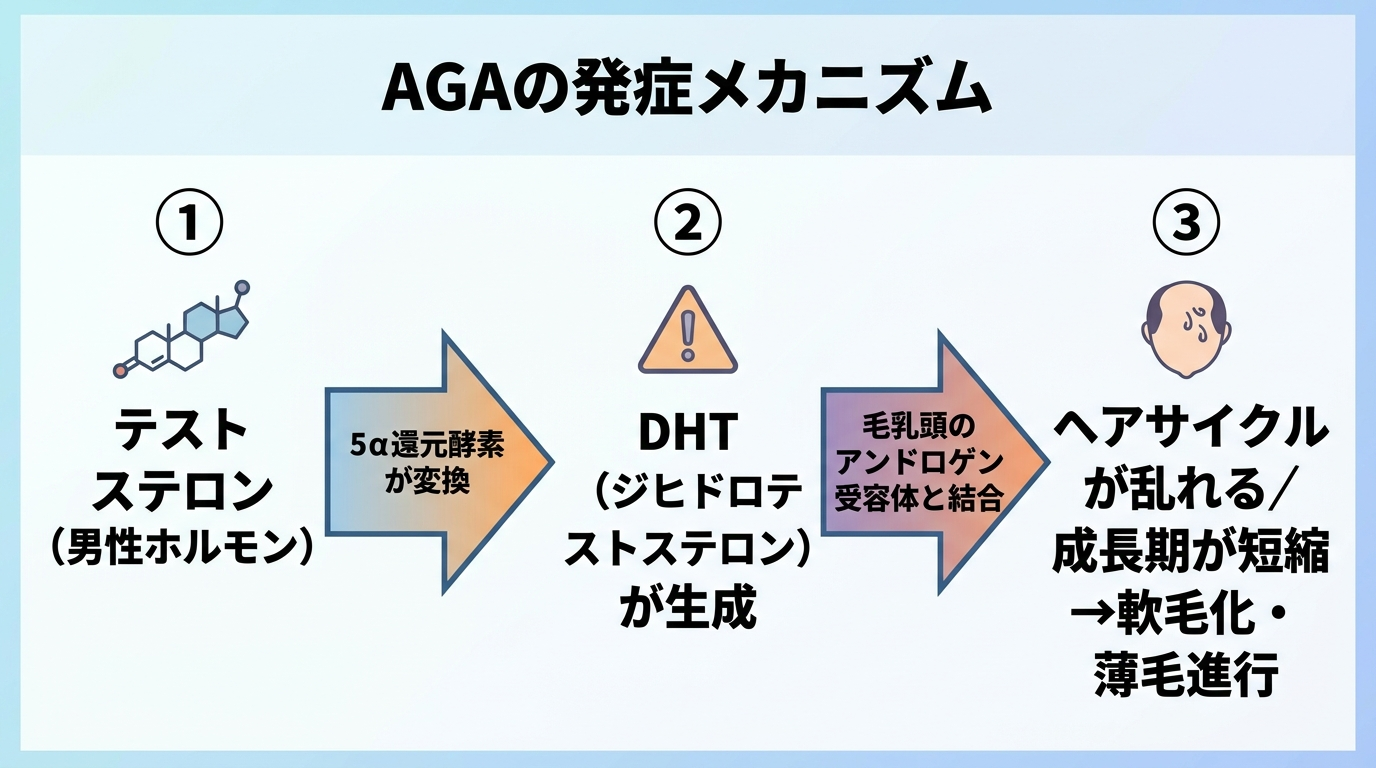 タイトル: AGAの発症メカニズム。横並び3ステップの矢印フロー図: ステップ1(分子アイコン)テストステロン(男性ホルモン)。矢印→5α還元酵素が変換。ステップ2(警告アイコン)DHT(ジヒドロテストステロン)が生成。矢印→毛乳頭のアンドロゲン受容体と結合。ステップ3(脱毛アイコン)ヘアサイクルが乱れる/成長期が短縮→軟毛化・薄毛進行
