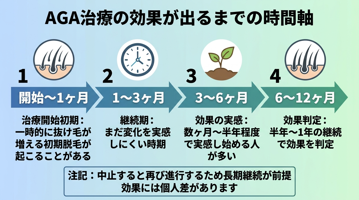 タイトル: AGA治療の効果が出るまでの時間軸。横並びのタイムライン図: 開始〜1ヶ月（初期脱毛のアイコン）治療開始初期: 一時的に抜け毛が増える初期脱毛が起こることがある。1〜3ヶ月（時計のアイコン）継続期: まだ変化を実感しにくい時期。3〜6ヶ月（芽のアイコン）効果の実感: 数ヶ月〜半年程度で実感し始める人が多い。6〜12ヶ月（毛髪のアイコン）効果判定: 半年〜1年の継続で効果を判定。注記: 中止すると再び進行するため長期継続が前提。効果には個人差があります。