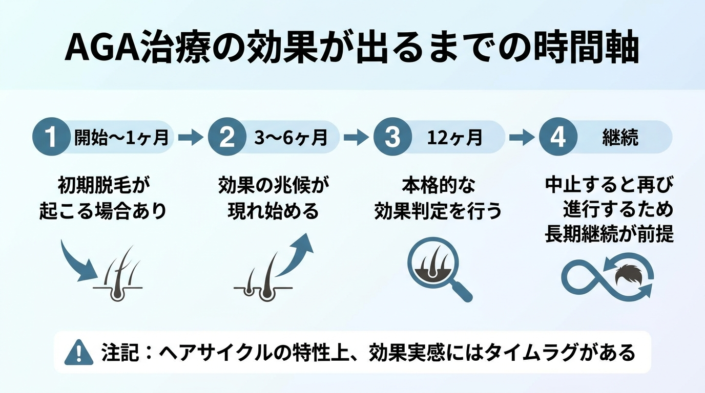 タイトル: AGA治療の効果が出るまでの時間軸。横向きの時系列フロー図: ステップ1(開始〜1ヶ月)初期脱毛が起こる場合あり。ステップ2(3〜6ヶ月)効果の兆候が現れ始める。ステップ3(12ヶ月)本格的な効果判定を行う。ステップ4(継続)中止すると再び進行するため長期継続が前提。各ステップを矢印でつなぎ、下部に注記『ヘアサイクルの特性上、効果実感にはタイムラグがある』