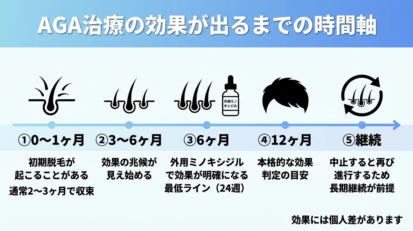 タイトル: AGA治療の効果が出るまでの時間軸。横向きタイムライン図: 0〜1ヶ月（初期脱毛が起こることがある・通常2〜3ヶ月で収束）→ 3〜6ヶ月（効果の兆候が見え始める）→ 6ヶ月（外用ミノキシジルで効果が明確になる最低ライン・24週）→ 12ヶ月（本格的な効果判定の目安）→ 継続（中止すると再び進行するため長期継続が前提）。下部注記: 効果には個人差があります