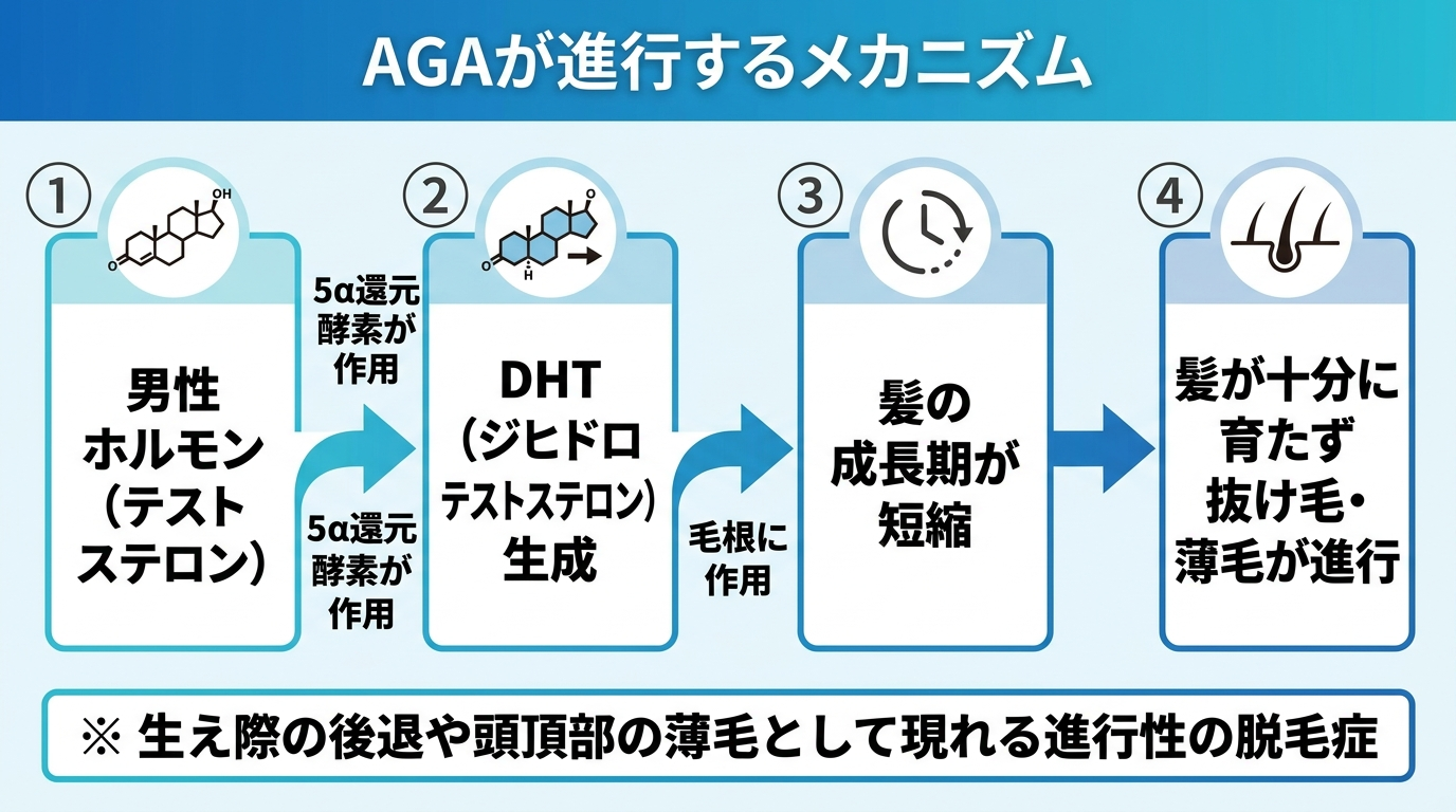 タイトル: AGAが進行するメカニズム。左から右へのフロー図。ステップ1: 男性ホルモン（テストステロン）。矢印（5α還元酵素が作用）。ステップ2: DHT（ジヒドロテストステロン）生成。矢印（毛根に作用）。ステップ3: 髪の成長期が短縮。矢印。ステップ4: 髪が十分に育たず抜け毛・薄毛が進行。注記: 生え際の後退や頭頂部の薄毛として現れる進行性の脱毛症
