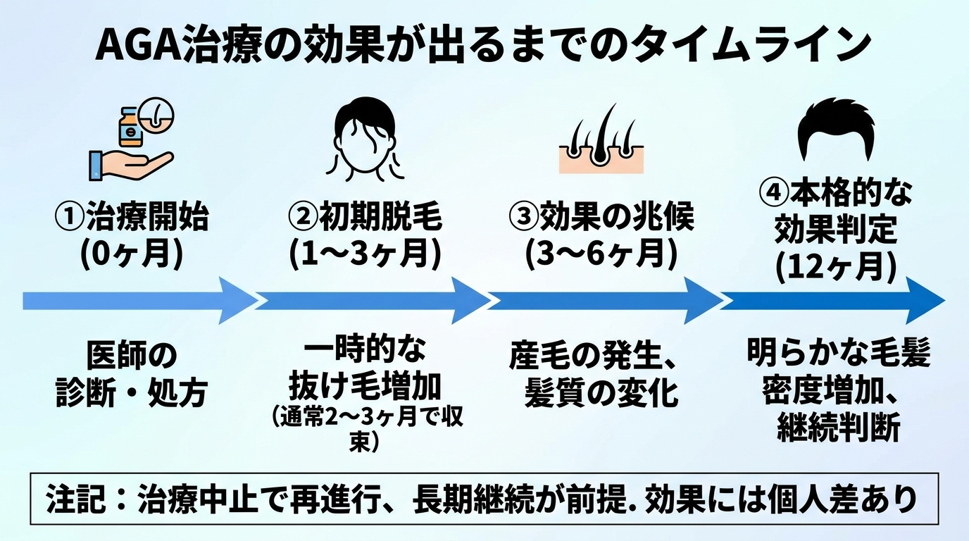 タイトル: AGA治療の効果が出るまでのタイムライン。横向きの時間軸フロー図。ステップ1: 治療開始(0ヶ月)。ステップ2: 初期脱毛(1〜3ヶ月、一時的に抜け毛が増えるが通常2〜3ヶ月で収束)。ステップ3: 効果の兆候(3〜6ヶ月)。ステップ4: 本格的な効果判定(12ヶ月)。注記: 治療を中止すると再び進行するため長期継続が前提。効果には個人差がある