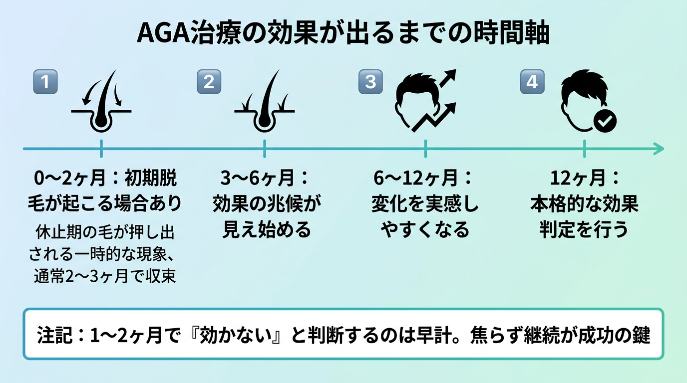 タイトル: AGA治療の効果が出るまでの時間軸。横向きタイムライン4段階で: 0〜2ヶ月: 初期脱毛が起こる場合あり(休止期の毛が押し出される一時的な現象、通常2〜3ヶ月で収束)。3〜6ヶ月: 効果の兆候が見え始める。6〜12ヶ月: 変化を実感しやすくなる。12ヶ月: 本格的な効果判定を行う。注記: 1〜2ヶ月で『効かない』と判断するのは早計。焦らず継続が成功の鍵