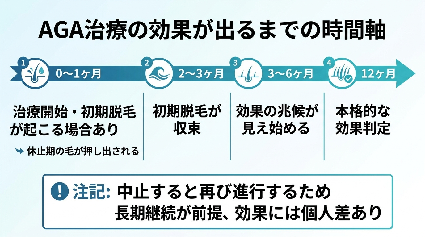 タイトル: AGA治療の効果が出るまでの時間軸。横方向のタイムライン図。0〜1ヶ月: 治療開始・初期脱毛が起こる場合あり(休止期の毛が押し出される)。2〜3ヶ月: 初期脱毛が収束。3〜6ヶ月: 効果の兆候が見え始める。12ヶ月: 本格的な効果判定。注記: 中止すると再び進行するため長期継続が前提、効果には個人差あり