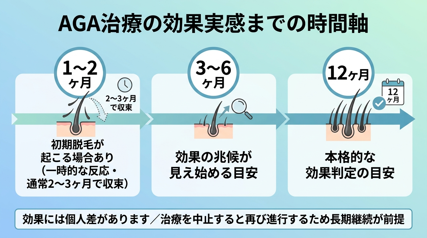 タイトル: AGA治療の効果実感までの時間軸。左から右への横向きタイムライン図で: 1〜2ヶ月: 初期脱毛が起こる場合あり（一時的な反応・通常2〜3ヶ月で収束）。3〜6ヶ月: 効果の兆候が見え始める目安。12ヶ月: 本格的な効果判定の目安。下部注記: 効果には個人差があります／治療を中止すると再び進行するため長期継続が前提
