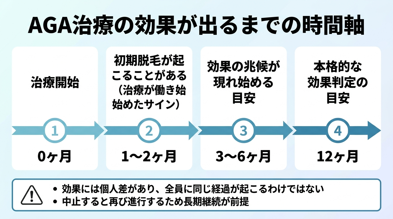 タイトル: AGA治療の効果が出るまでの時間軸。横向きのタイムライン図。0ヶ月: 治療開始。1〜2ヶ月: 初期脱毛が起こることがある(治療が働き始めたサイン)。3〜6ヶ月: 効果の兆候が現れ始める目安。12ヶ月: 本格的な効果判定の目安。注意書き: 効果には個人差があり、全員に同じ経過が起こるわけではない。中止すると再び進行するため長期継続が前提。