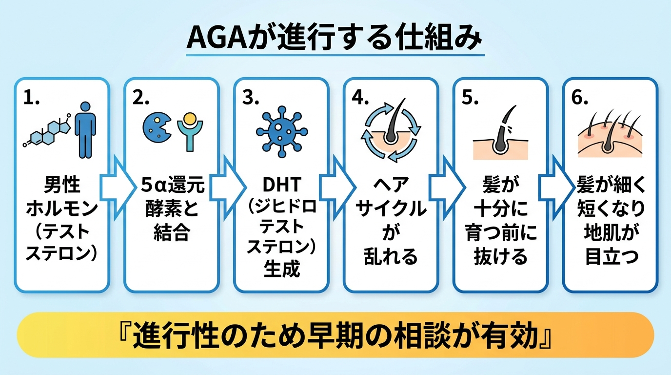 タイトル: AGAが進行する仕組み。左から右へのフロー図: 男性ホルモン（テストステロン）→ 5α還元酵素と結合 → DHT（ジヒドロテストステロン）生成 → ヘアサイクルが乱れる → 髪が十分に育つ前に抜ける → 髪が細く短くなり地肌が目立つ。下部に補足『進行性のため早期の相談が有効』