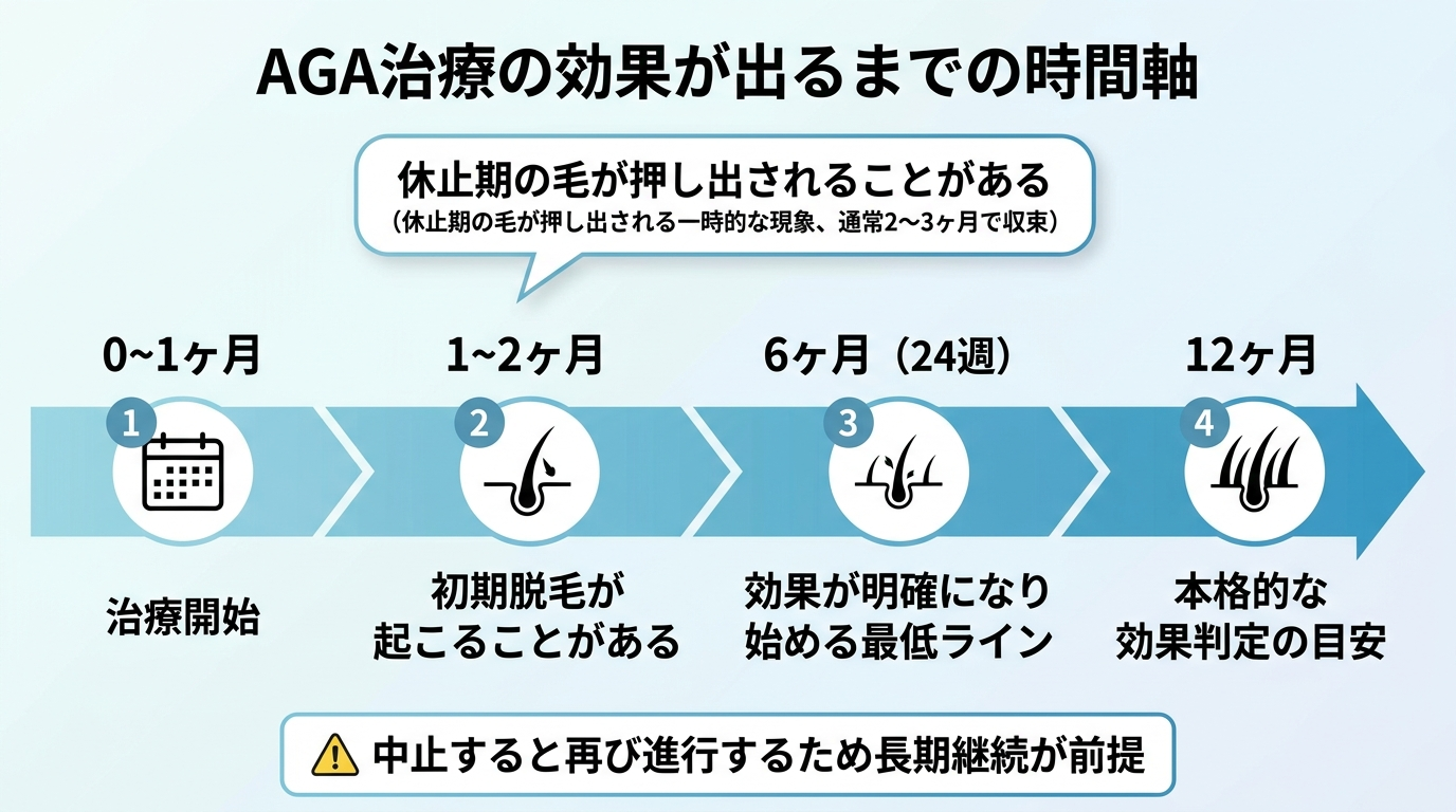 タイトル: AGA治療の効果が出るまでの時間軸。横向きの時間軸図で: 0〜1ヶ月: 治療開始。1〜2ヶ月: 初期脱毛が起こることがある(休止期の毛が押し出される一時的な現象、通常2〜3ヶ月で収束)。6ヶ月(24週): 効果が明確になり始める最低ライン。12ヶ月: 本格的な効果判定の目安。下部注記: 中止すると再び進行するため長期継続が前提。