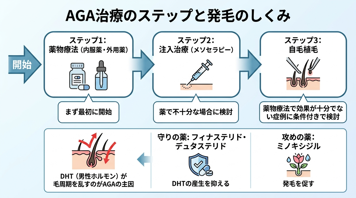 タイトル: AGA治療のステップと発毛のしくみ。フロー図形式。ステップ1: 薬物療法(内服薬・外用薬)まず最初に開始。ステップ2: 注入治療(メソセラピー)薬で不十分な場合に検討。ステップ3: 自毛植毛 薬物療法で効果が十分でない症例に条件付きで検討。補足: DHT(男性ホルモン)が毛周期を乱すのがAGAの主因。フィナステリド・デュタステリドはDHTの産生を抑える守りの薬、ミノキシジルは発毛を促す攻めの薬。