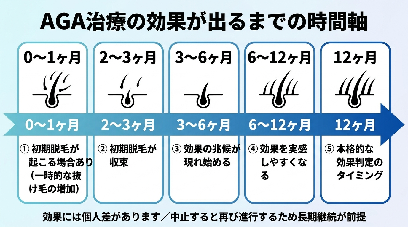 タイトル: AGA治療の効果が出るまでの時間軸。横向きのタイムライン図: 0〜1ヶ月: 初期脱毛が起こる場合あり(一時的な抜け毛の増加)。2〜3ヶ月: 初期脱毛が収束。3〜6ヶ月: 効果の兆候が現れ始める。6〜12ヶ月: 効果を実感しやすくなる。12ヶ月: 本格的な効果判定のタイミング。下部に注記: 効果には個人差があります/中止すると再び進行するため長期継続が前提