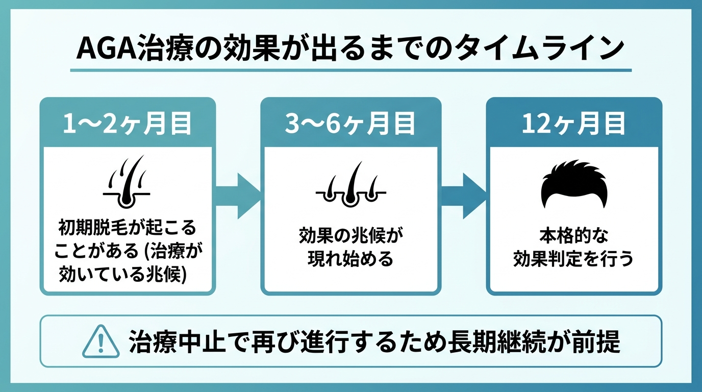 タイトル: AGA治療の効果が出るまでのタイムライン。横並び時系列フロー: 1〜2ヶ月目: 初期脱毛が起こることがある(治療が効いている兆候)。3〜6ヶ月目: 効果の兆候が現れ始める。12ヶ月目: 本格的な効果判定を行う。下部に注記: 治療中止で再び進行するため長期継続が前提