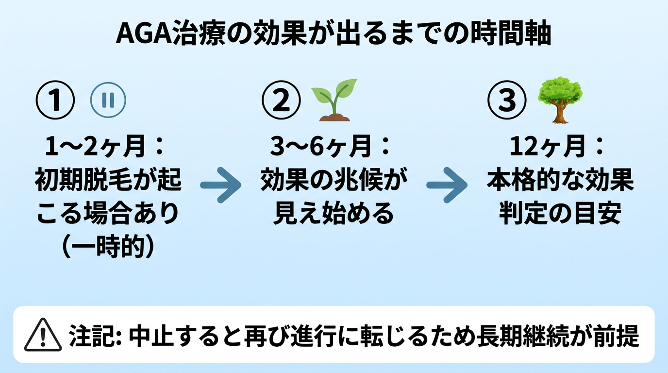 タイトル: AGA治療の効果が出るまでの時間軸。横型タイムライン形式で: 1〜2ヶ月: 初期脱毛が起こる場合あり(一時的)。3〜6ヶ月: 効果の兆候が見え始める。12ヶ月: 本格的な効果判定の目安。注記: 中止すると再び進行に転じるため長期継続が前提