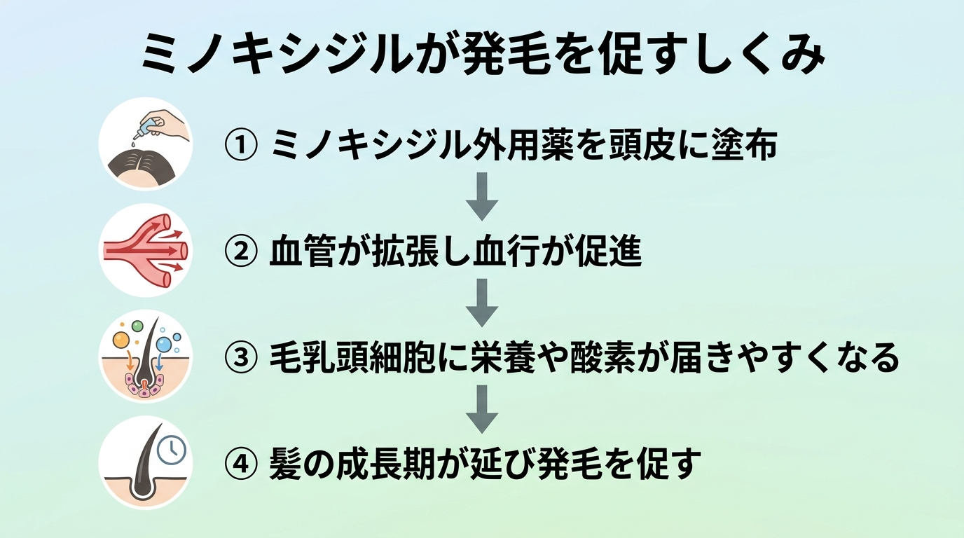 タイトル: ミノキシジルが発毛を促すしくみ。縦フロー図で4ステップ: ステップ1(頭皮に塗布のアイコン)ミノキシジル外用薬を頭皮に塗布。ステップ2(血管拡張のアイコン)血管が拡張し血行が促進。ステップ3(毛根への栄養供給のアイコン)毛乳頭細胞に栄養や酸素が届きやすくなる。ステップ4(髪の成長のアイコン)髪の成長期が延び発毛を促す