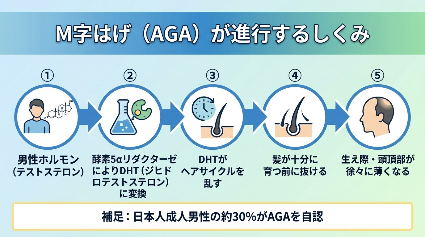 タイトル: M字はげ（AGA）が進行するしくみ。フロー図で左から右へ: ①男性ホルモン（テストステロン）→ ②酵素5αリダクターゼによりDHT（ジヒドロテストステロン）に変換 → ③DHTがヘアサイクルを乱す → ④髪が十分に育つ前に抜ける → ⑤生え際・頭頂部が徐々に薄くなる。補足: 日本人成人男性の約30%がAGAを自認