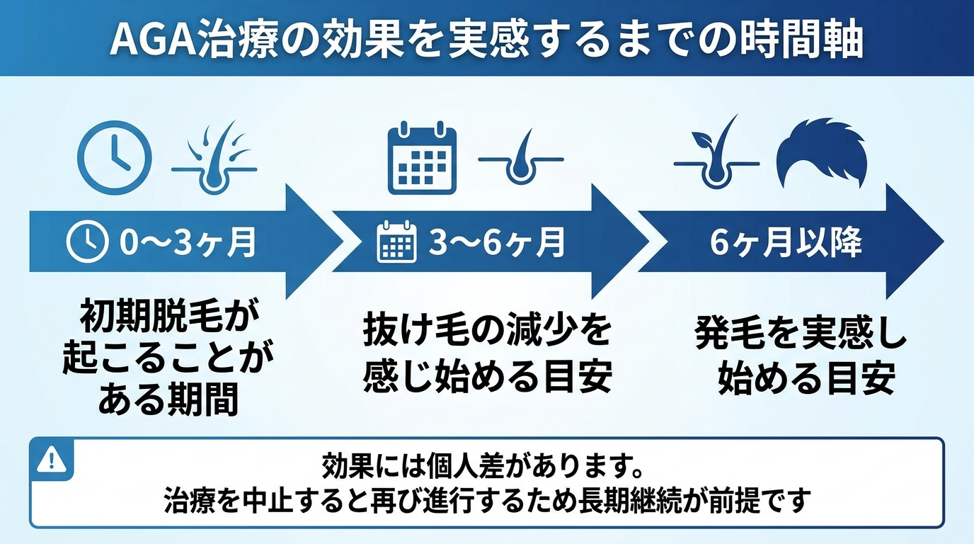 タイトル: AGA治療の効果を実感するまでの時間軸。横向きの時間軸フロー図: 0〜3ヶ月(初期脱毛が起こることがある期間)→ 3〜6ヶ月(抜け毛の減少を感じ始める目安)→ 6ヶ月以降(発毛を実感し始める目安)。下部に注記: 効果には個人差があります。治療を中止すると再び進行するため長期継続が前提です