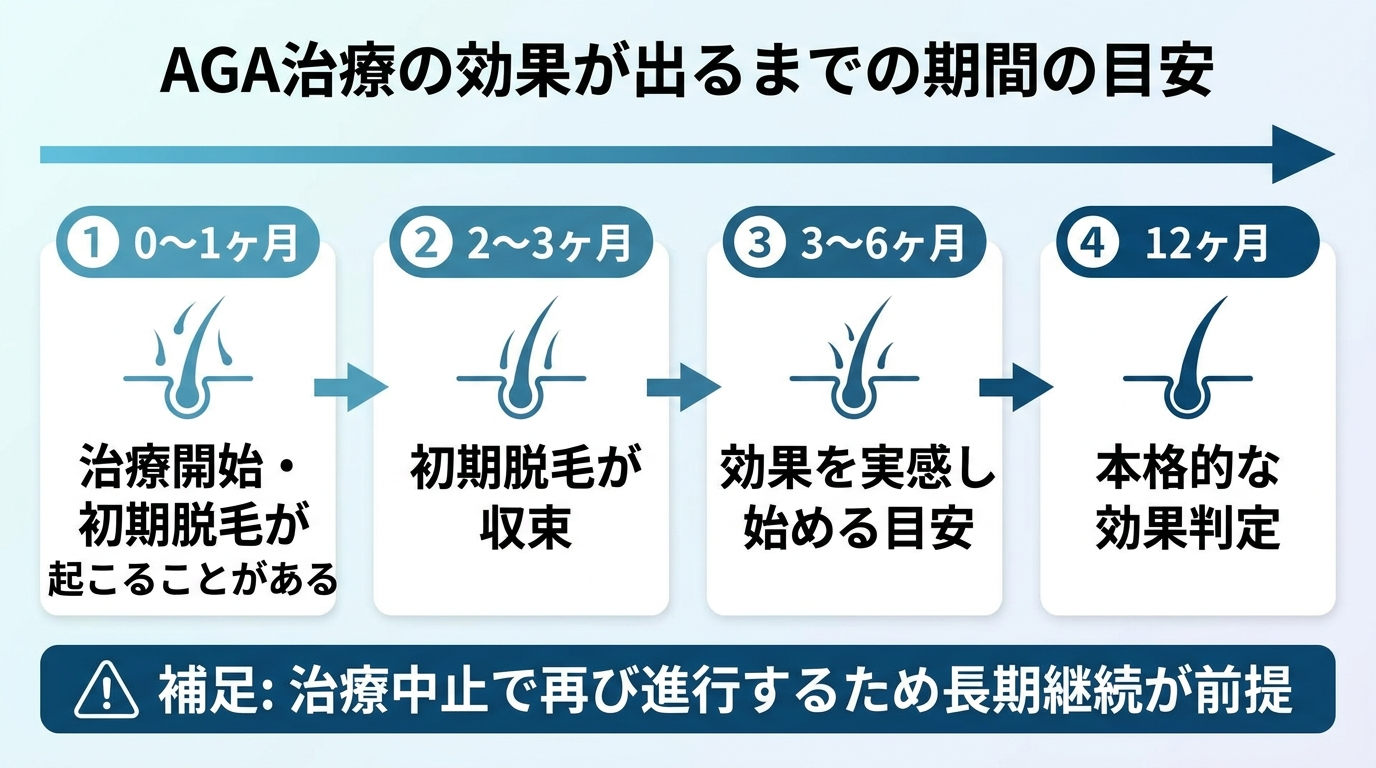 タイトル: AGA治療の効果が出るまでの期間の目安。横方向のタイムライン図: 0〜1ヶ月(治療開始・初期脱毛が起こることがある)→ 2〜3ヶ月(初期脱毛が収束)→ 3〜6ヶ月(効果を実感し始める目安)→ 12ヶ月(本格的な効果判定)。補足: 治療中止で再び進行するため長期継続が前提